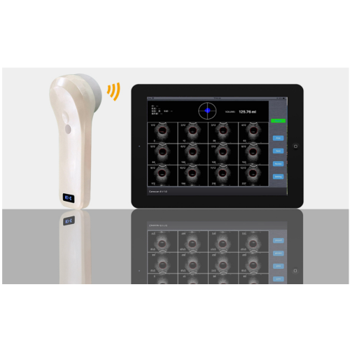 Scanner à ultrasons de la vessie sans fil